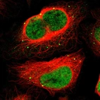 Immunofluorescent staining of human cell line U-2 OS shows localization to nucleoplasm & vesicles.