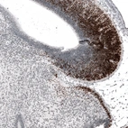 Anti-BARHL1 Antibody