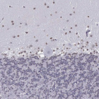 Immunohistochemical staining of human cerebellum shows weak nuclear positivity in cells in molecular layer.