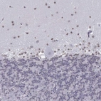 Immunohistochemical staining of human cerebellum shows weak nuclear positivity in cells in molecular layer.