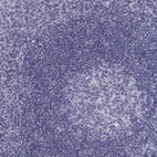 Immunohistochemical staining of human tonsil shows no positivity in non-germinal center cells as expected.