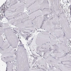 Immunohistochemical staining of human skeletal muscle shows no positivity in myocytes as expected.