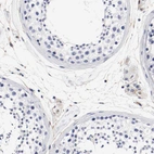 Immunohistochemical staining of human testis shows no membranous positivity in cells in seminiferous ducts as expected.