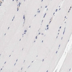 Immunohistochemical staining of human skeletal muscle shows no membranous positivity in myocytes as expected.