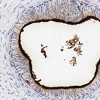 Immunohistochemical staining of human epididymis shows strong membranous positivity in ependymal cells.