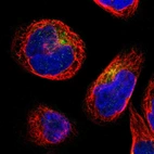 Immunofluorescent staining of human cell line A-431 shows localization to cytosol.