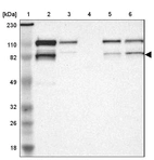 Lane 1: Marker [kDa] 230, 110, 82, 49, 32, 26, 18_br/_Lane 2: Human cell line RT-4_br/_Lane 3: Human cell line U-251MG sp_br/_Lane 4: Human plasma (IgG/HSA depleted)_br/_Lane 5: Human liver tissue_br/_Lane 6: Human tonsil tissue