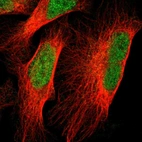 Immunofluorescent staining of human cell line U-2 OS shows localization to nucleoplasm.