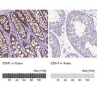 Anti-CDH1 Antibody