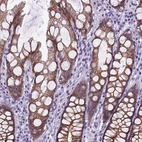 Immunohistochemical staining of human colon shows moderate positivity in plasma membrane in glandular cells.