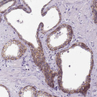 Anti-CDH1 Antibody