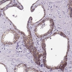 Immunohistochemical staining of human prostate shows moderate positivity in plasma membrane in glandular cells.