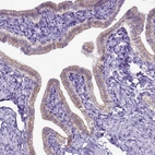 Immunohistochemical staining of human fallopian tube shows moderate positivity in plasma membrane of glandular cells.