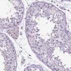 Immunohistochemical staining of human testis shows no positivity in cells in seminiferous ducts as expected.