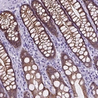 Immunohistochemical staining of human colon shows strong positivity in plasma membrane in glandular cells.