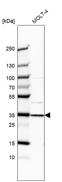Anti-GTF2E2 Antibody