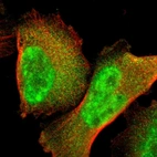 Immunofluorescent staining of human cell line U-251 MG shows localization to nucleoplasm & cytosol.