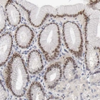 Immunohistochemical staining of human stomach shows moderate to strong nuclear positivity in glandular cells.