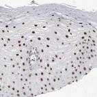 Immunohistochemical staining of human cervix shows moderate to strong nuclear positivity in squamous epithelial cells.