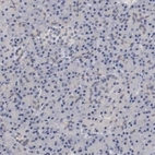 Immunohistochemical staining of human pancreas shows no positivity in exocrine glandular cells as expected.