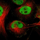 Immunofluorescent staining of human cell line U-251 MG shows localization to nucleoplasm.