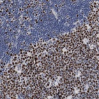 Immunohistochemical staining of human lymph node shows high expression.