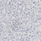 Immunohistochemical staining of human liver shows low expression as expected.
