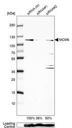 Western blot analysis in U2OS cells transfected with control siRNA, target specific siRNA probe #1 and #2, using Anti-MCM6 antibody. Remaining relative intensity is presented. Loading control: Anti-GAPDH.