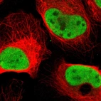 Immunofluorescent staining of human cell line U-2 OS shows localization to nucleoplasm.