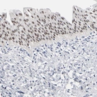 Immunohistochemical staining of human urinary bladder shows strong nuclear positivity in urothelial cells.