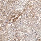 Anti-TNC Antibody