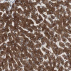Immunohistochemical staining of human liver shows strong cytoplasmic positivity in hepatocytes.