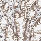 Immunohistochemical staining of human rectum shows moderate cytoplasmic positivity in glandular cells.