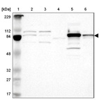Lane 1: Marker [kDa] 229, 112, 84, 48, 32, 27, 17_br/_Lane 2: Human cell line RT-4_br/_Lane 3: Human cell line U-251MG sp_br/_Lane 4: Human plasma (IgG/HSA depleted)_br/_Lane 5: Human liver tissue_br/_Lane 6: Human tonsil tissue