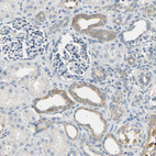 Immunohistochemical staining of human kidney shows weak cytoplasmic positivity in cells in tubules.