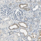 Immunohistochemical staining of human kidney shows weak cytoplasmic positivity in cells in tubules.