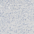 Anti-USP13 Antibody