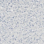 Immunohistochemical staining of human liver shows no positivity in hepatocytes as expected.