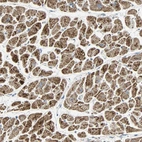 Immunohistochemical staining of human heart muscle shows strong granular cytoplasmic positivity in cardiomyocytes.