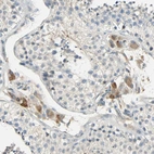 Immunohistochemical staining of human testis shows moderate granular cytoplasmic positivity in Leydig cells.