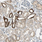 Immunohistochemical staining of human kidney shows strong granular cytoplasmic positivity in cells in tubules.