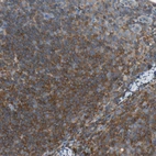 Immunohistochemical staining of human lymph node shows strong cytoplasmic positivity in germinal center cells.