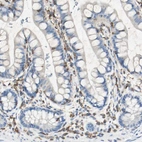Immunohistochemical staining of human small intestine shows moderate cytoplasmic positivity in lymphoid cells.