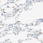 Immunohistochemical staining of human lung shows weak cytoplasmic positivity in macrophages.