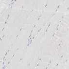 Immunohistochemical staining of human skeletal muscle shows no positivity in myocytes as expected.