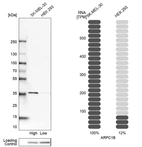 Western blot analysis in human cell lines SK-MEL-30 and HEK293 using Anti-ARPC1B antibody. Corresponding ARPC1B RNA-seq data are presented for the same cell lines. Loading control: Anti-HDAC1.