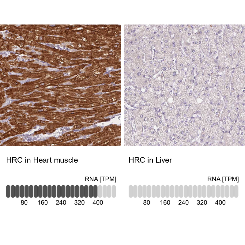 Anti-HRC Antibody