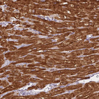 Immunohistochemical staining of human heart muscle shows strong cytoplasmic positivity in cardiomyocytes.