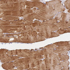 Immunohistochemical staining of human skeletal muscle shows strong cytoplasmic positivity in myocytes.