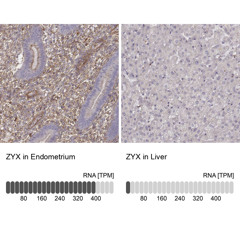 Anti-ZYX Antibody